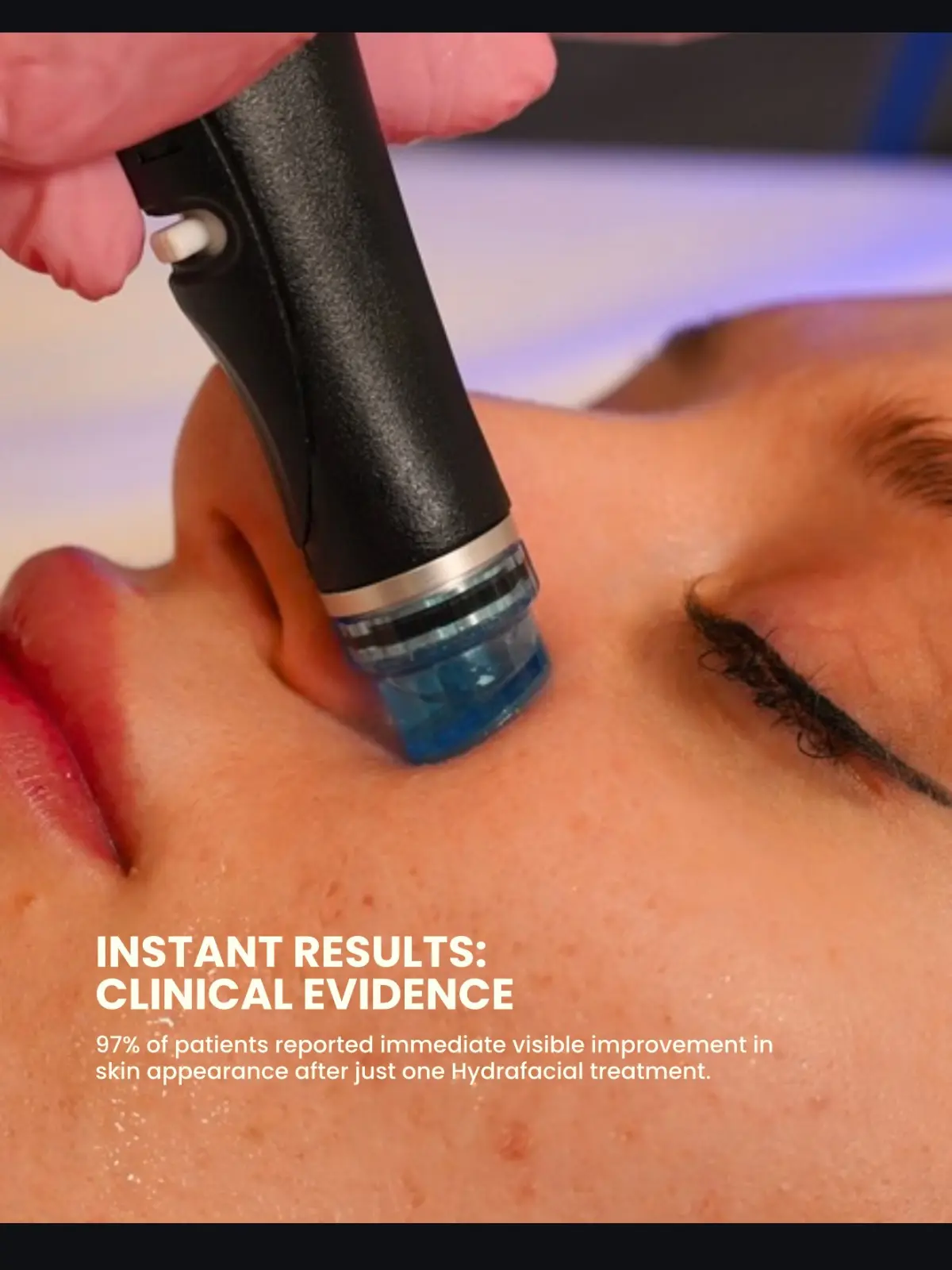 #2 HydraFacial & Chinese Style Head Spa 90min
