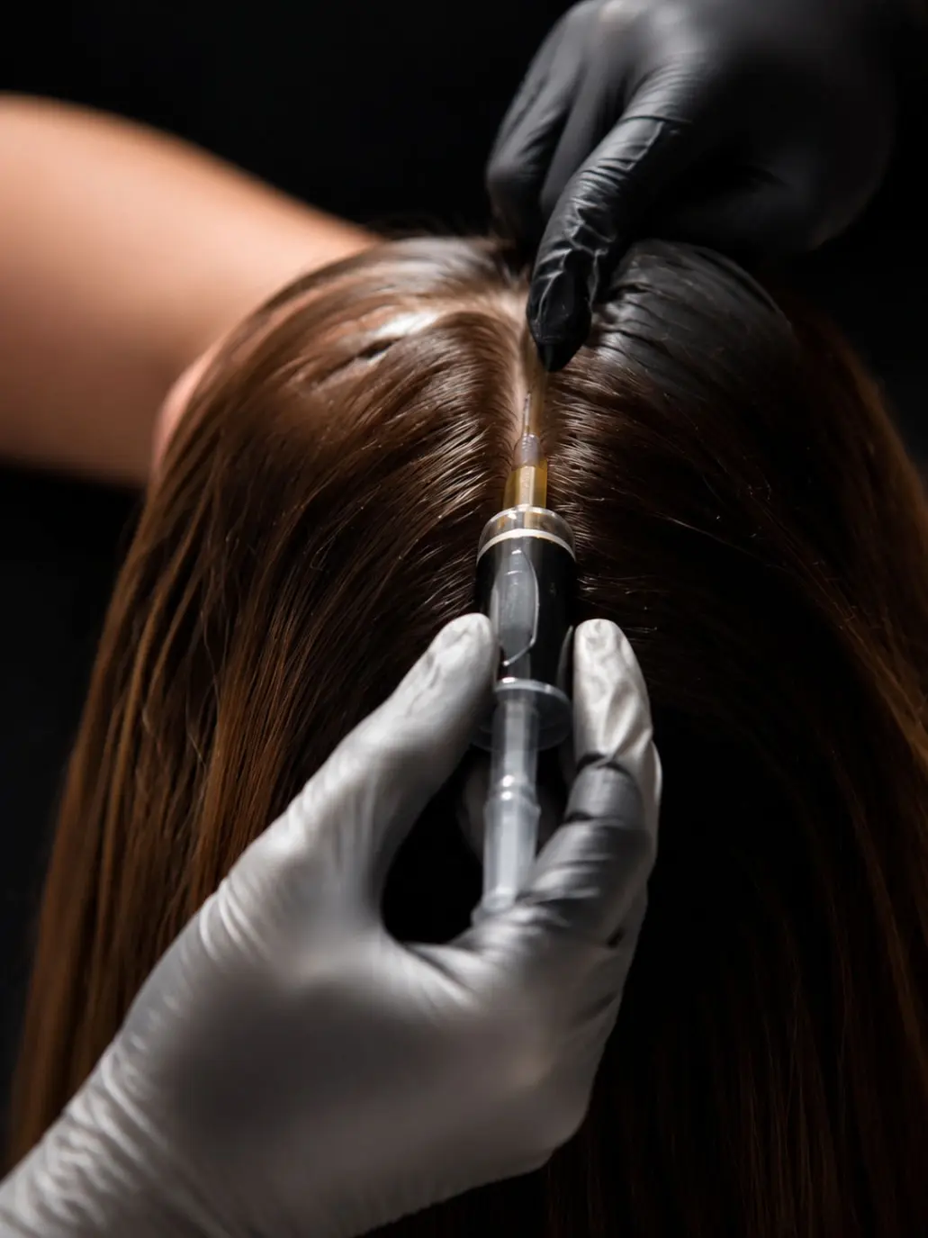 KERAVIVE™ Partial Scalp Treatment